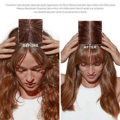 Bain Crème Anti-pelliculaire Symbiose Kérastase